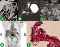 Preoperative studies