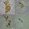 Light micrographs showing the pattern of distribution of insulin-immunoreactive cells in the pancreatic islets of young/elderly ZL/ZDF rats